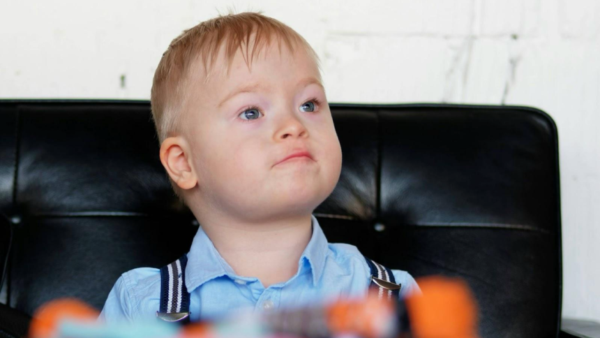 Down Syndrome Everything you need to know