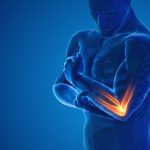 Managing Chronic Pain After an Injury