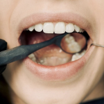 Top 10 Tips for Caring for Your Dental Implants