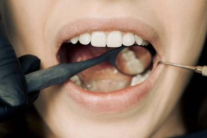 Top 10 Tips for Caring for Your Dental Implants