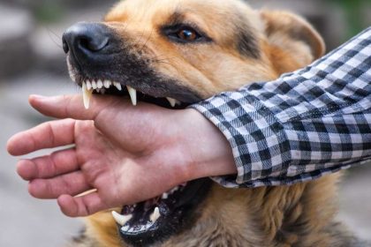 Why You Should Hire a Personal Injury Lawyer for a Dog Bite Case